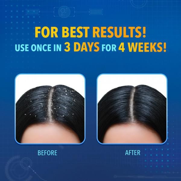 Scalpe Plus Expert Anti Dandruff Shampoo